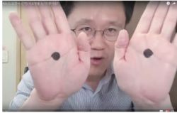 강창용 서울그린치과 원장, 충치 과잉진료 실태 고발로 인기 